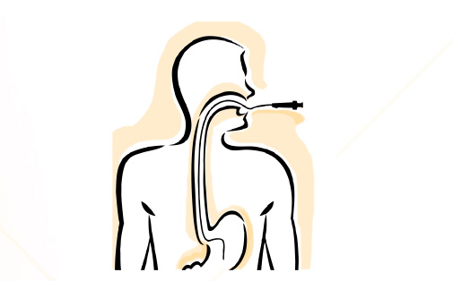 gastroscopy1